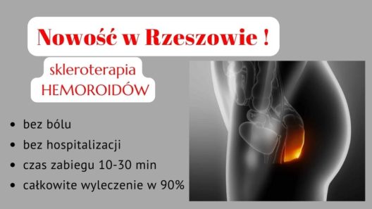 Skleroterapia hemoroidów Rzeszów