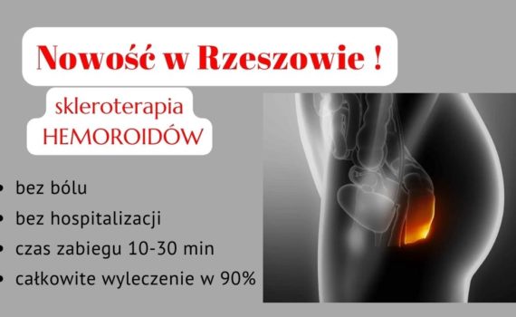 Skleroterapia hemoroidów Rzeszów